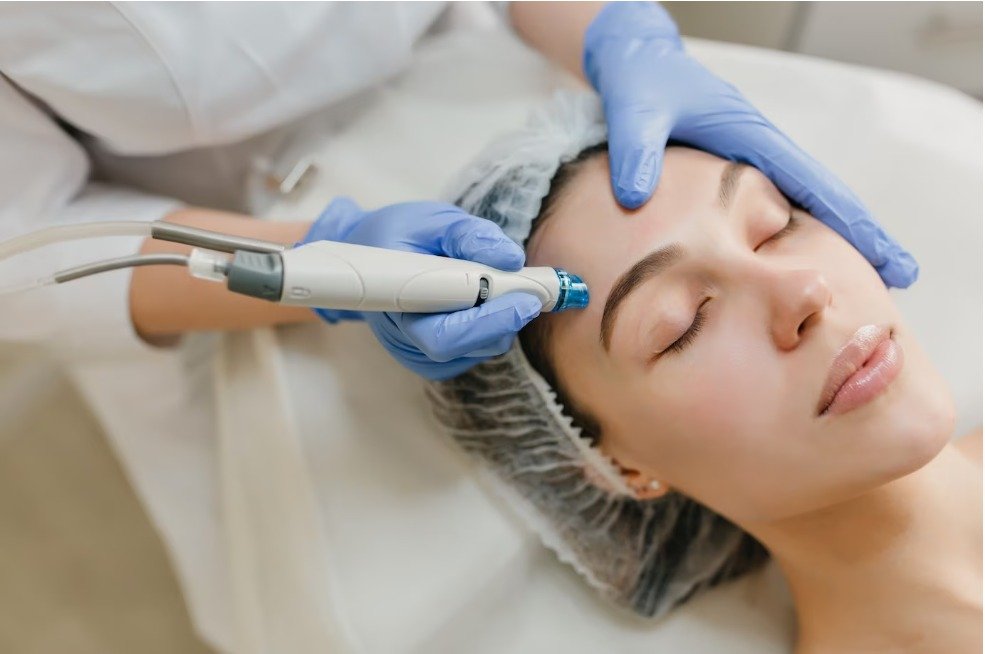 Microneedling pen used during a facial treatment