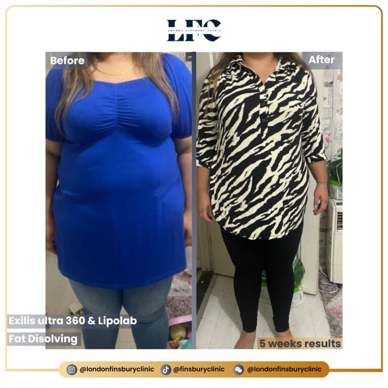 WhatsApp Image 2023-11-02 at 20.02.40