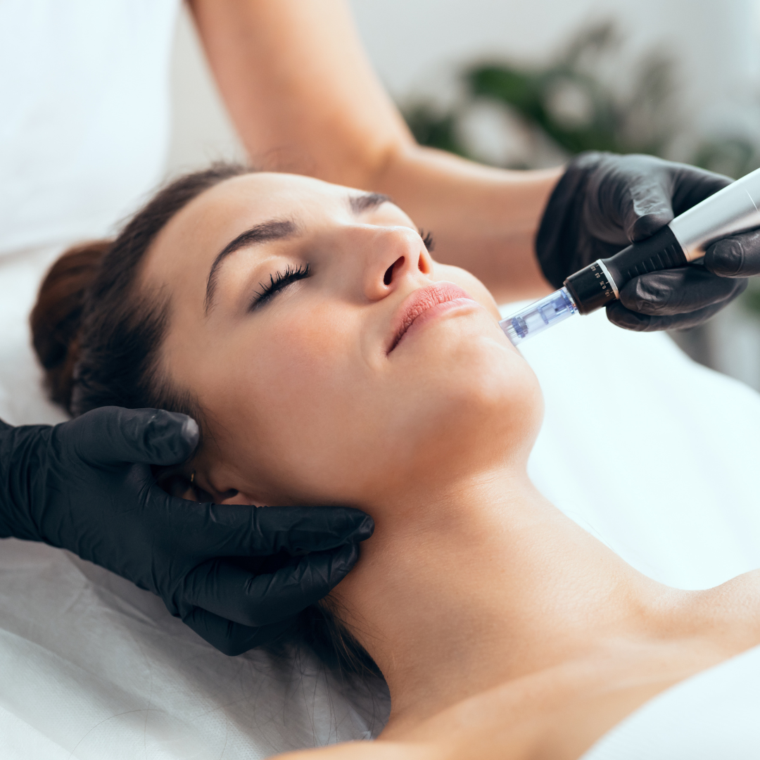 Microneedling pen applied during a facial skin treatment
