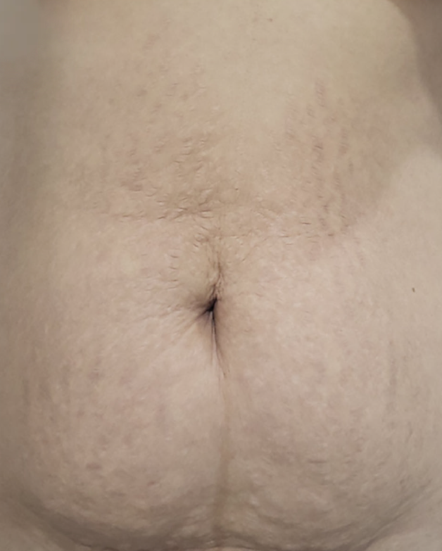 Lenisna After 06.jpg