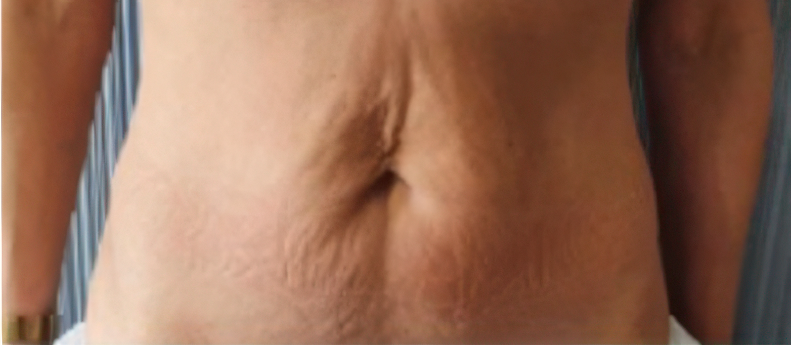 Lenisna Before 05.jpg