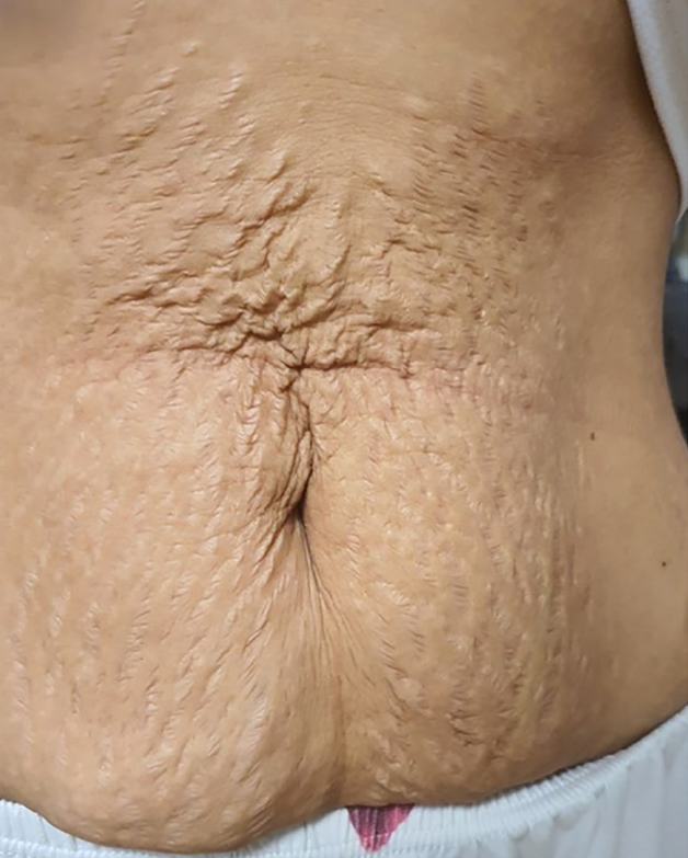 Lenisna Before 06.jpg